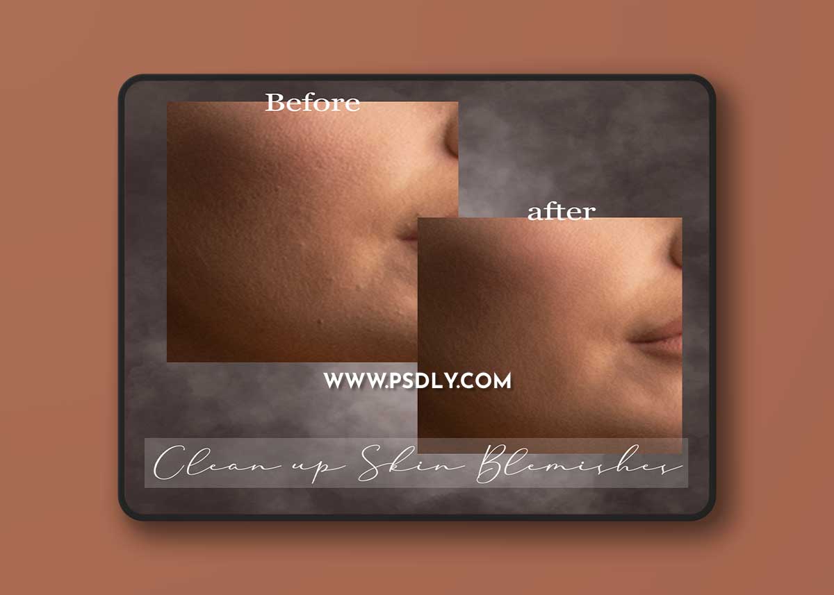 Sweet Soul Studio - Clean up Skin Blemishes