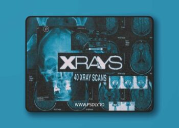 X-Rays Image Pack 12698205
